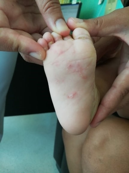 bpi-die-gute-nachricht-kraetze-das-juckt-mich-nicht